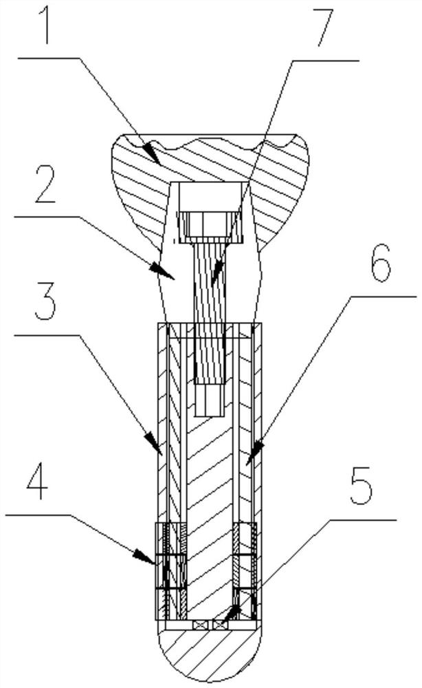 An anti-rotation and anti-dislocation oral implant system