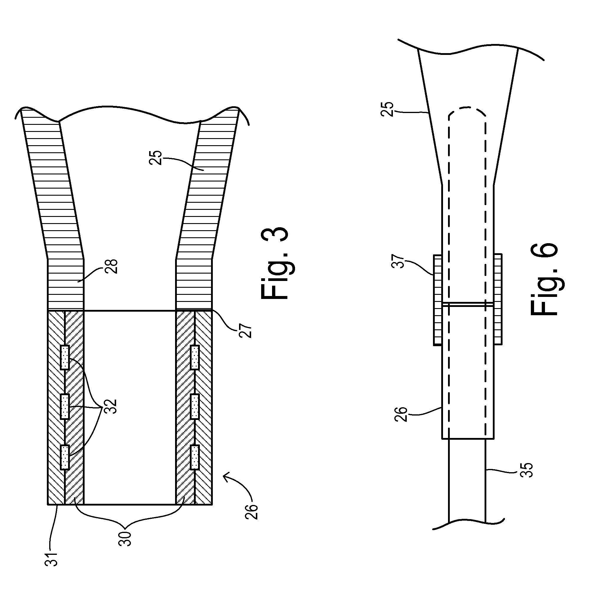 Medical catheter with bump tubing proximal segment