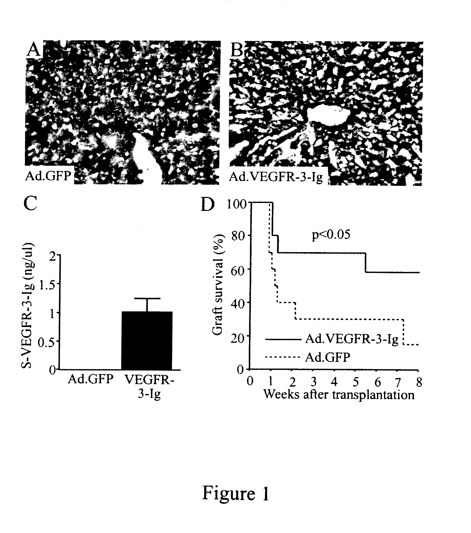 Growth factor antagonists for organ transplant alloimmunity and arteriosclerosis