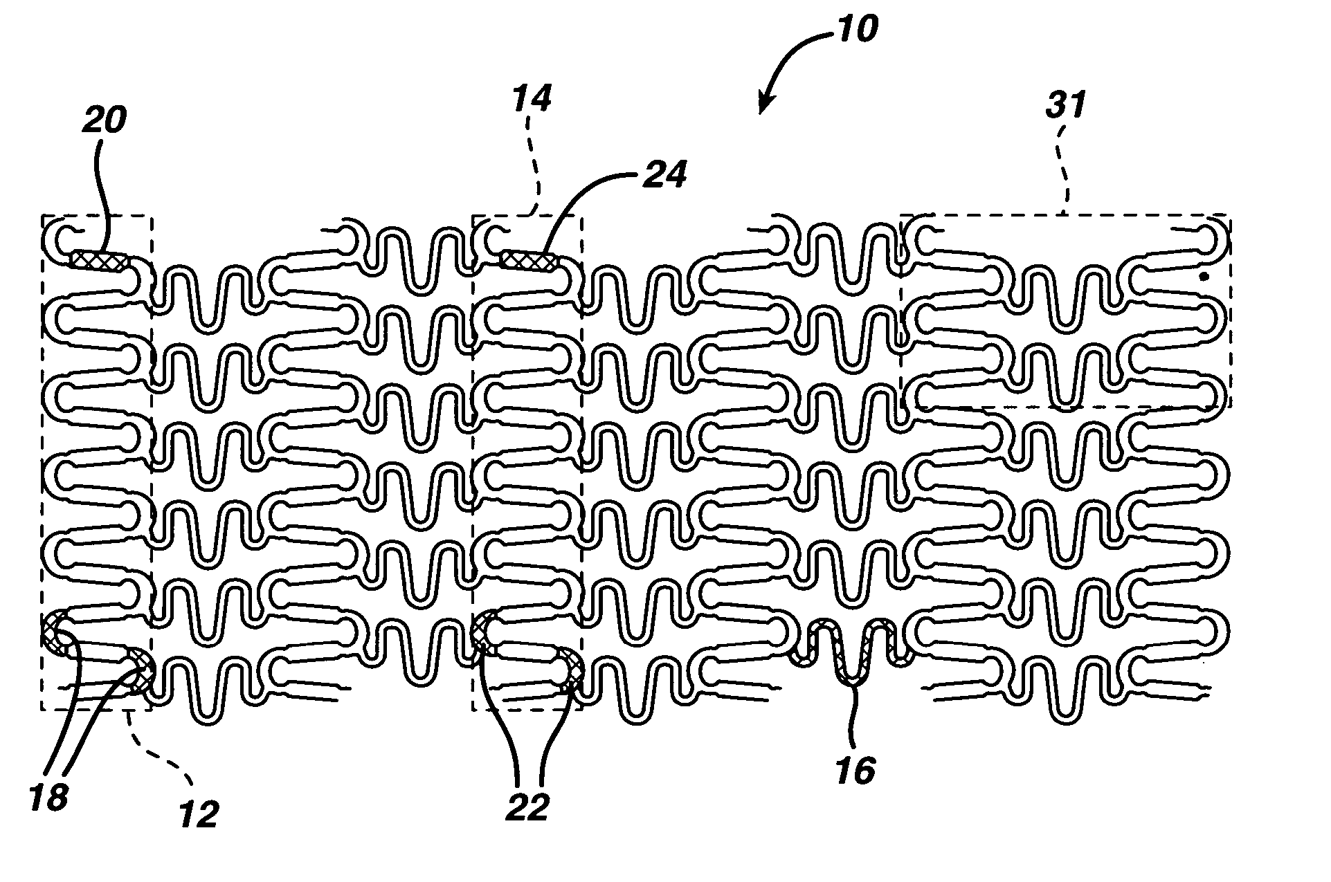 Magnetic resonance imaging compatibility alloy for implantable medical devices