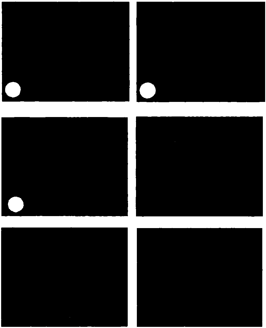 Pharmaceutical composition for treating radiation proctitis