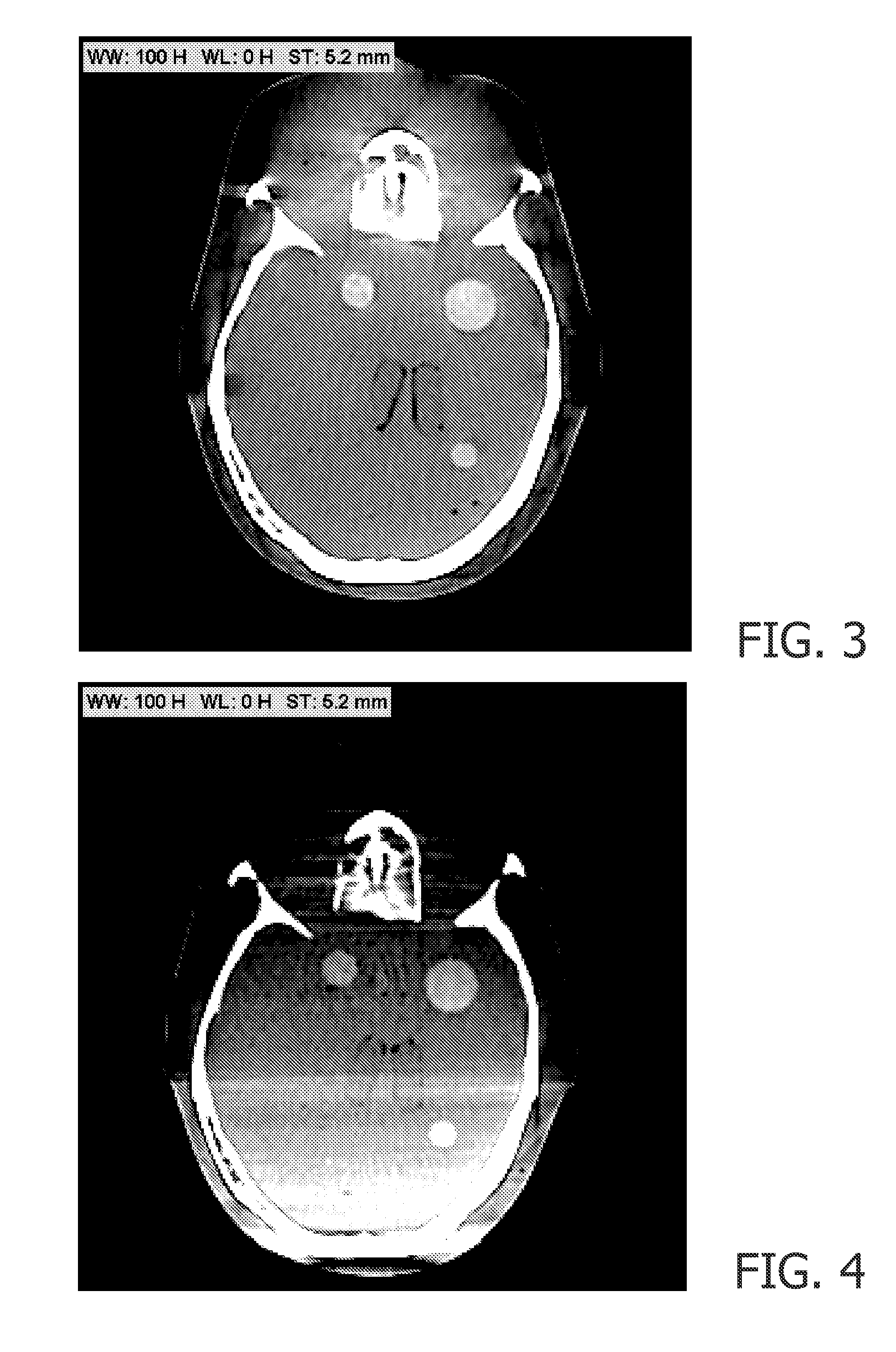 Computer Tomography (CT) C-arm system and method for examination of an object