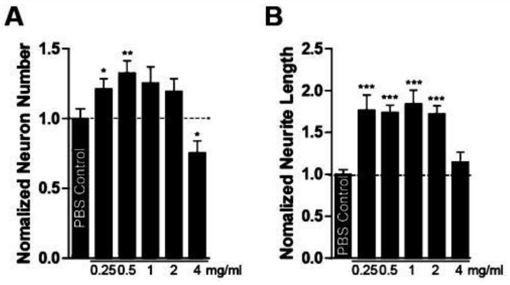 Preparation method of transferrin, transferrin-containing composition and application