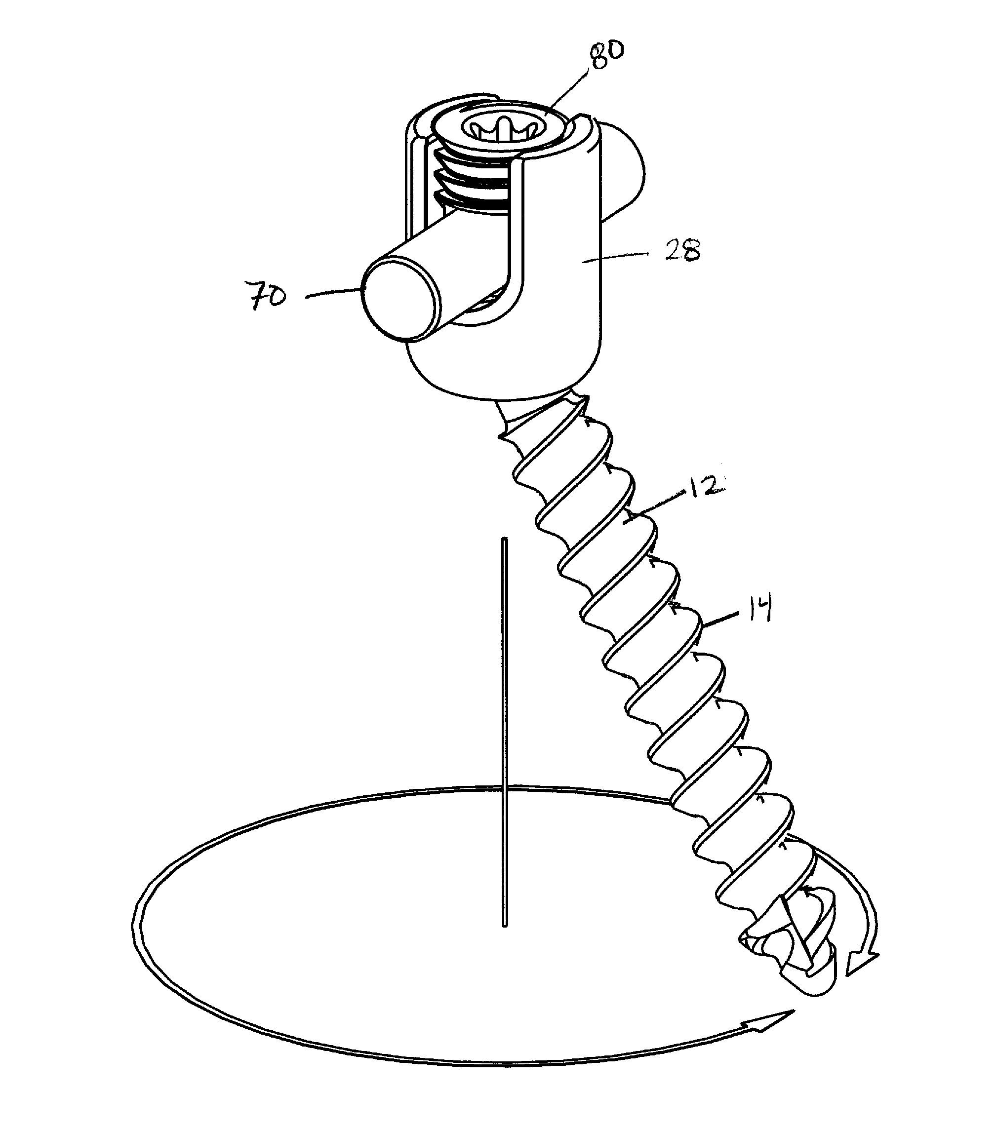 Spring clip bottom loading polyaxial ball and socket fastener