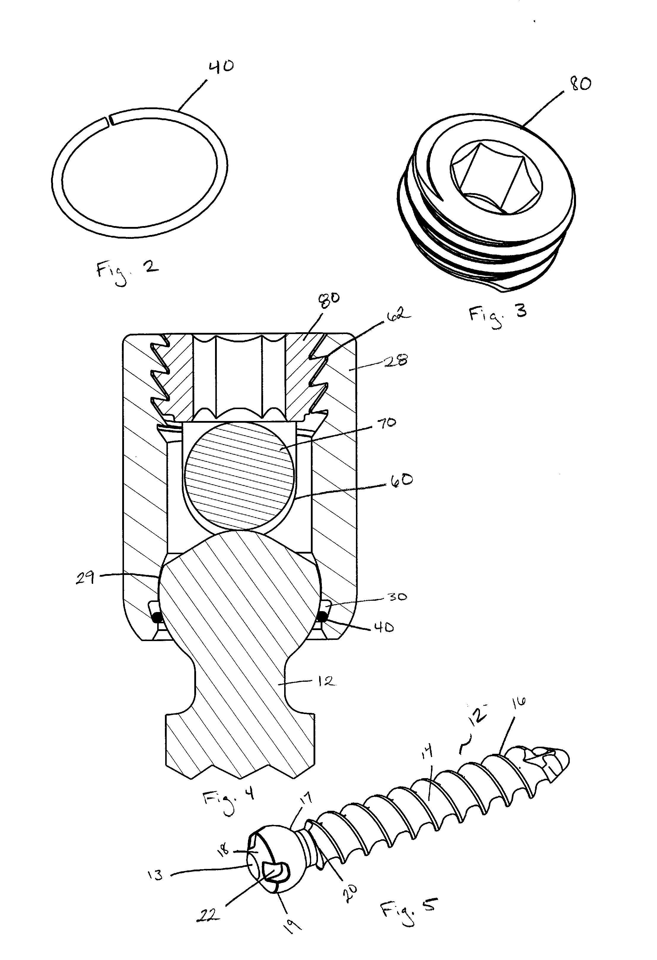 Spring clip bottom loading polyaxial ball and socket fastener