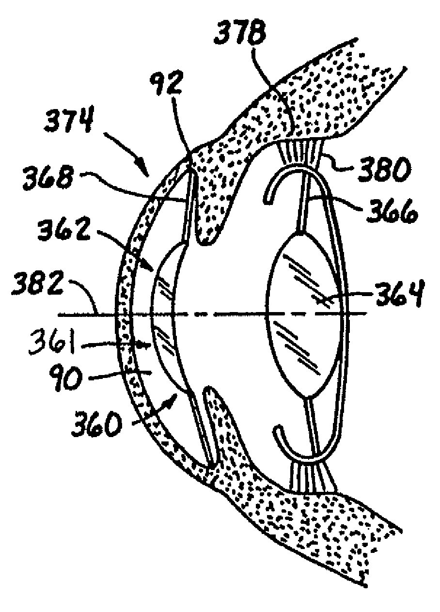 Ophthalmic lens combinations