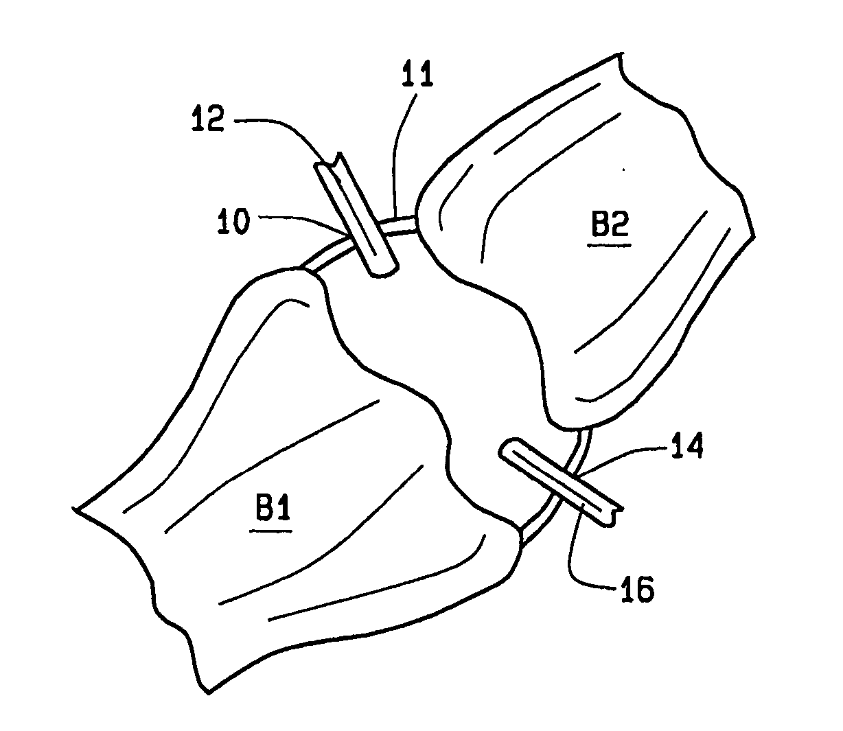 Arthoscopic arthroplasty procedure for the repair or reconstruction of arthritic joints