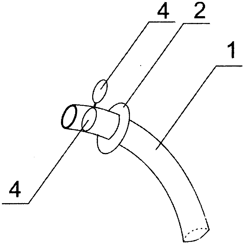 Switch device for plugging of inner sleeve during tracheostomy