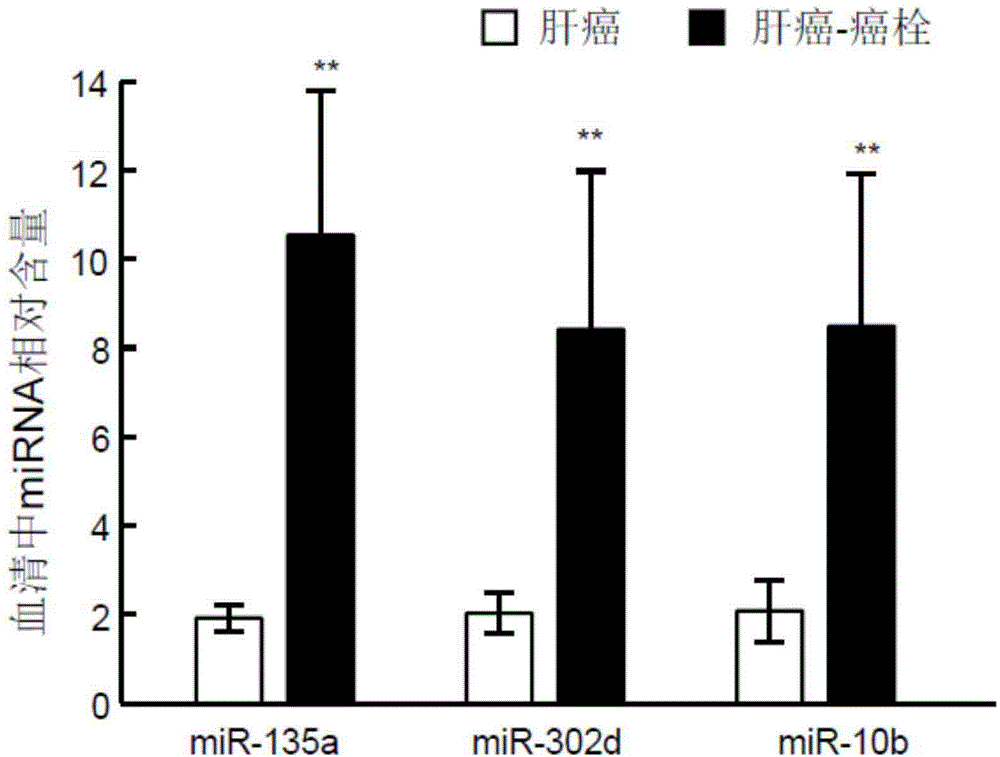 Hsa-mir-135a, hsa-mir-302d and hsa-mir-10b joint detection kit for detecting liver cancer genesis or metastasis early