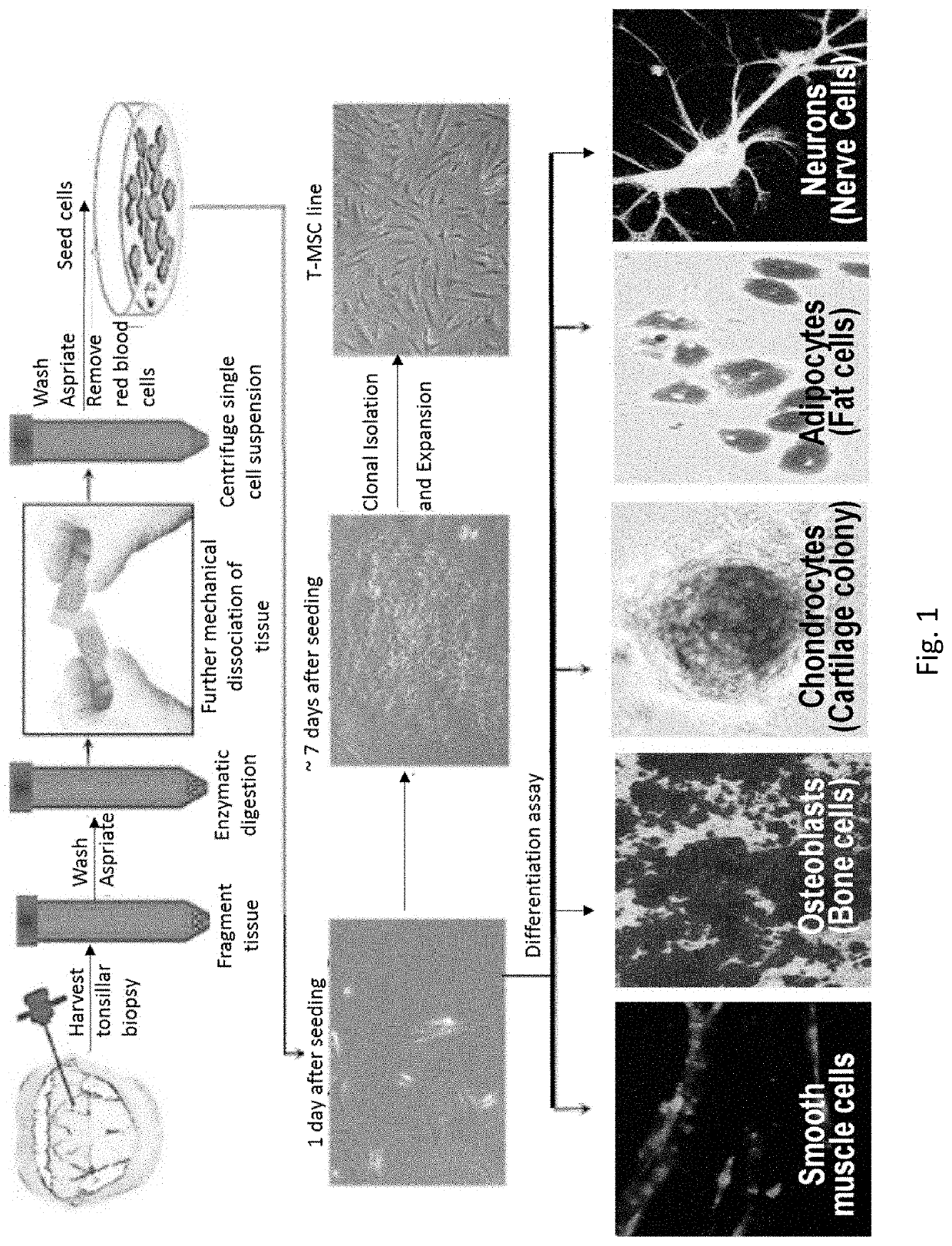 Methods for generating multipotent stem cells from tonsillar biopsies