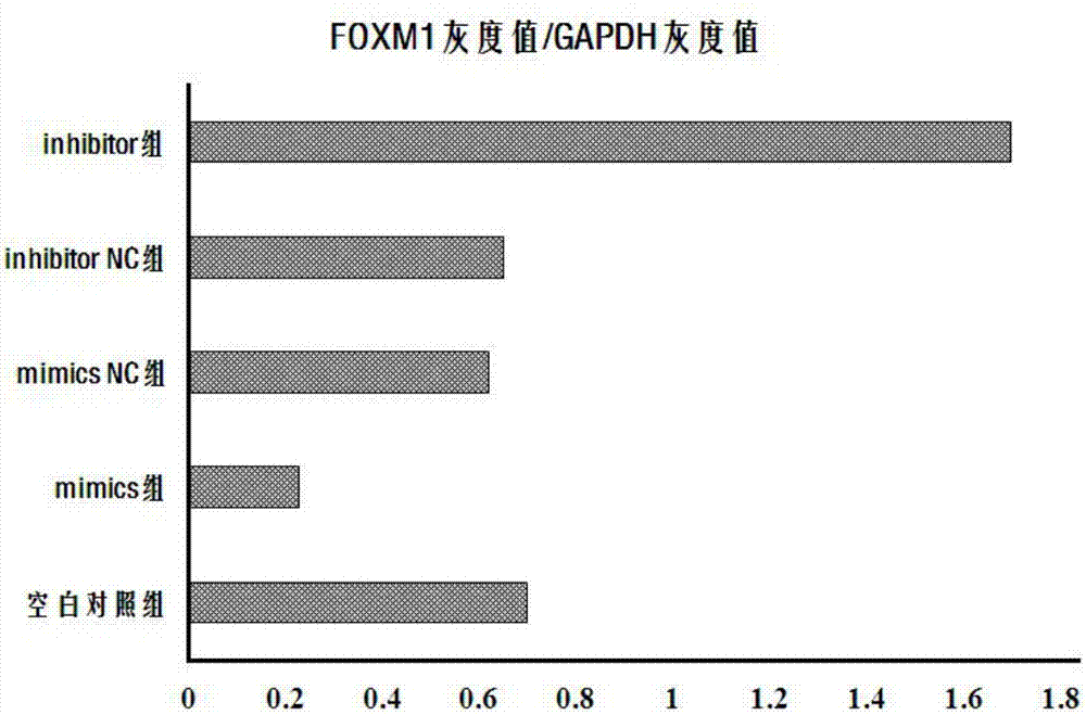 Application of miR-134 and target gene FOXM1 to preparation of mesenchymal stem cell-based pancreatic cancer targeted vector