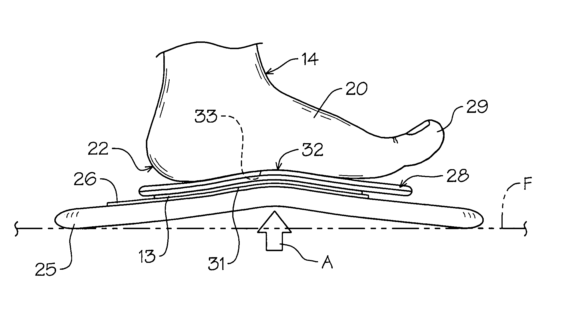 Customized molded orthotic shoe insert method and apparatus