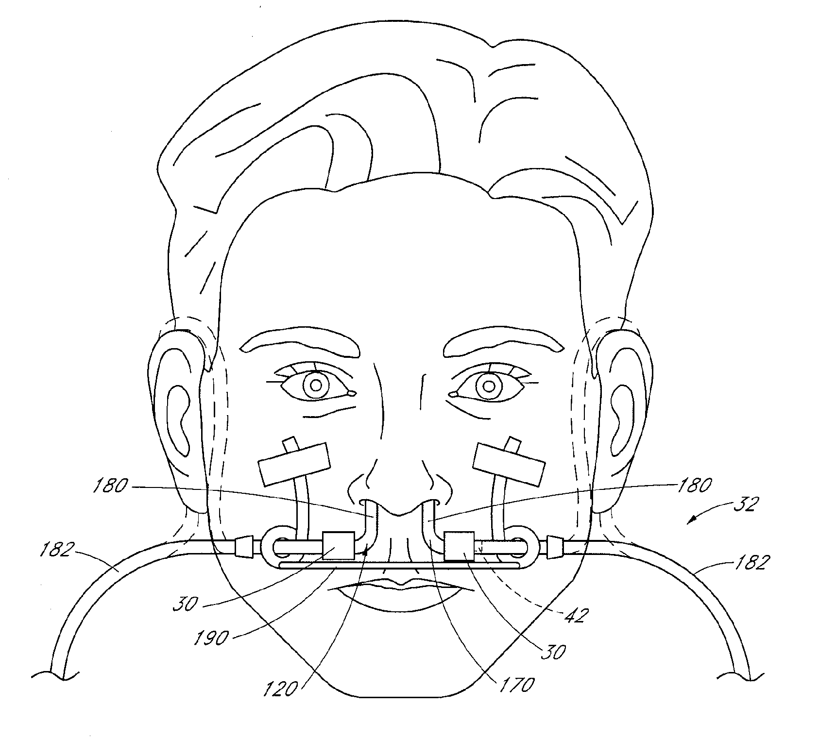 Breathing gas delivery system and method