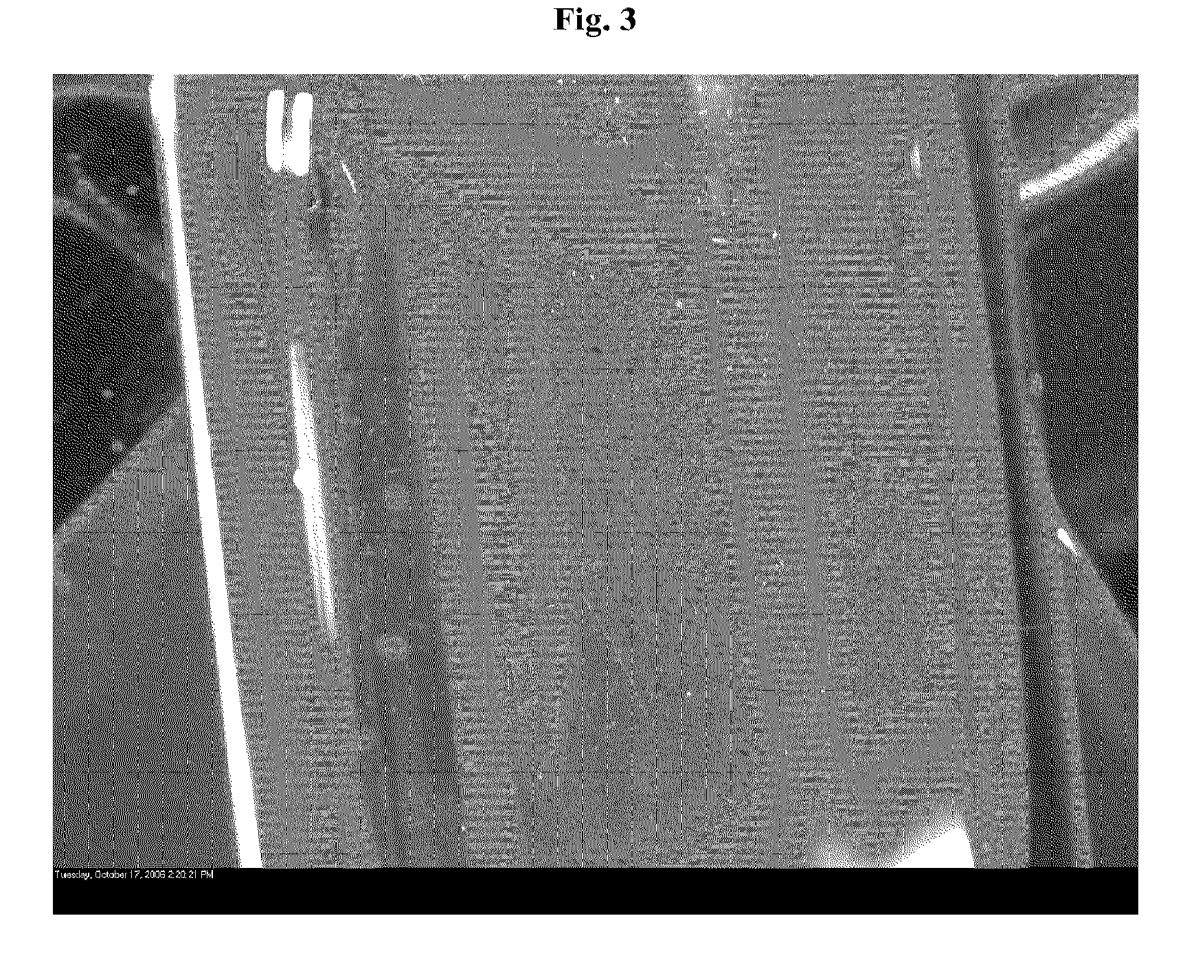 Compositions comprising deoxycholic acid and salts thereof suitable for use in treating fat deposits