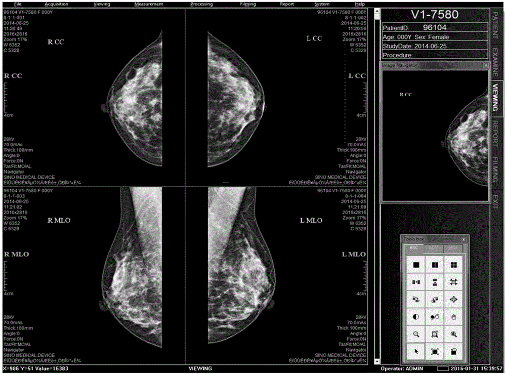 Mammary-gland remote viewing method and system