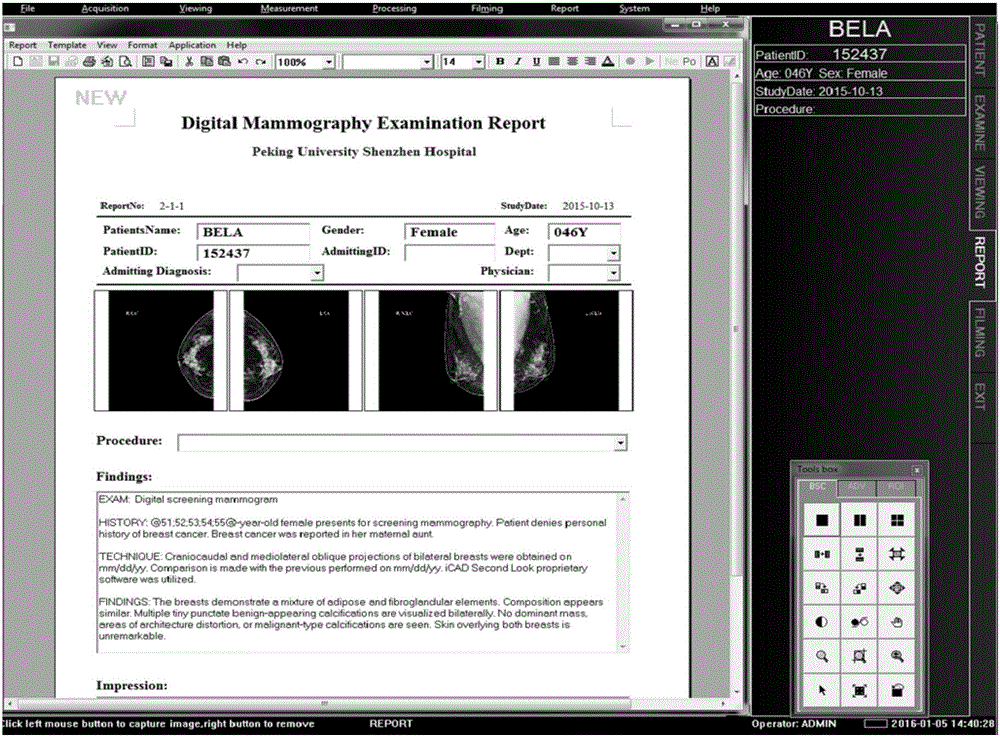 Mammary-gland remote viewing method and system