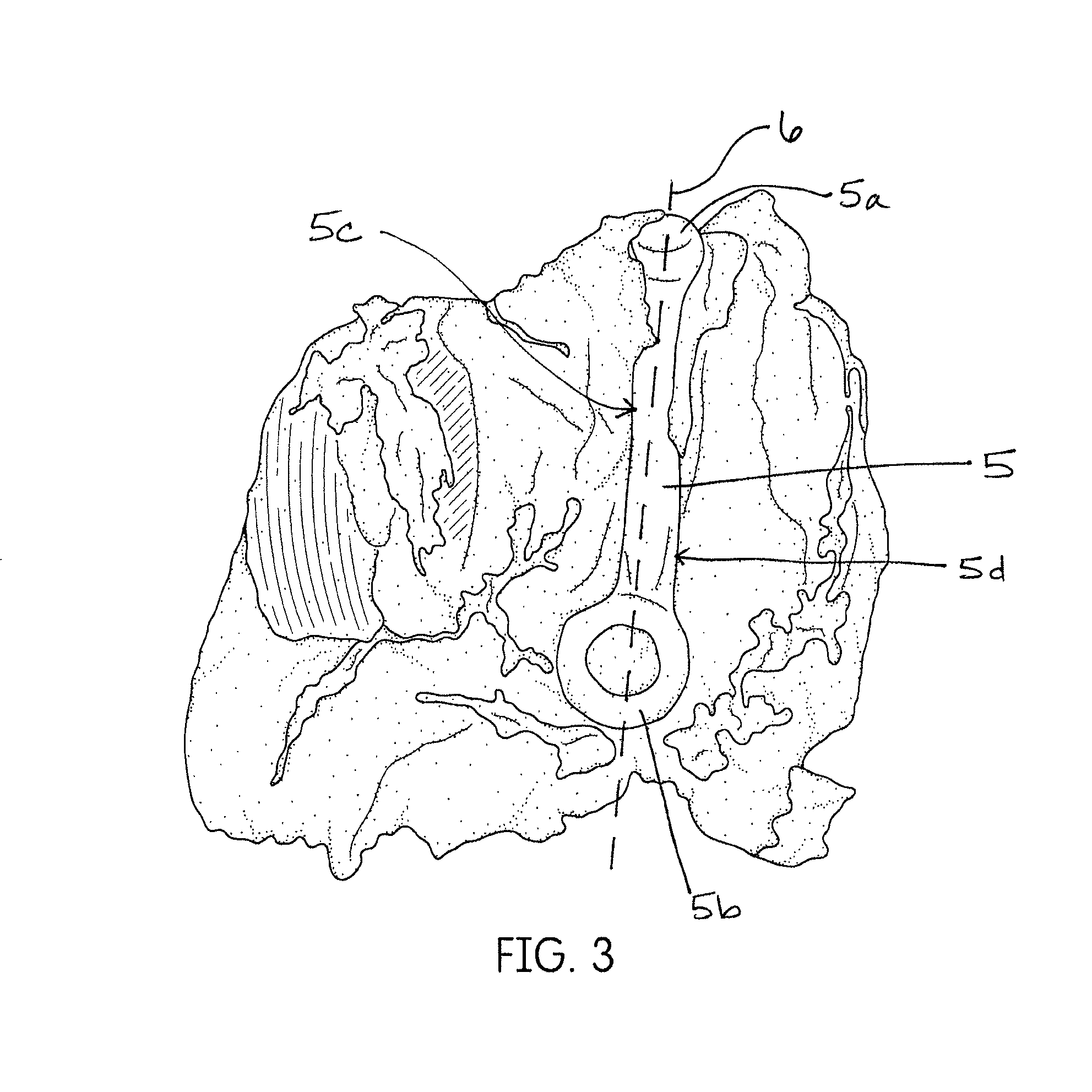 Methods for processing poultry thigh meat