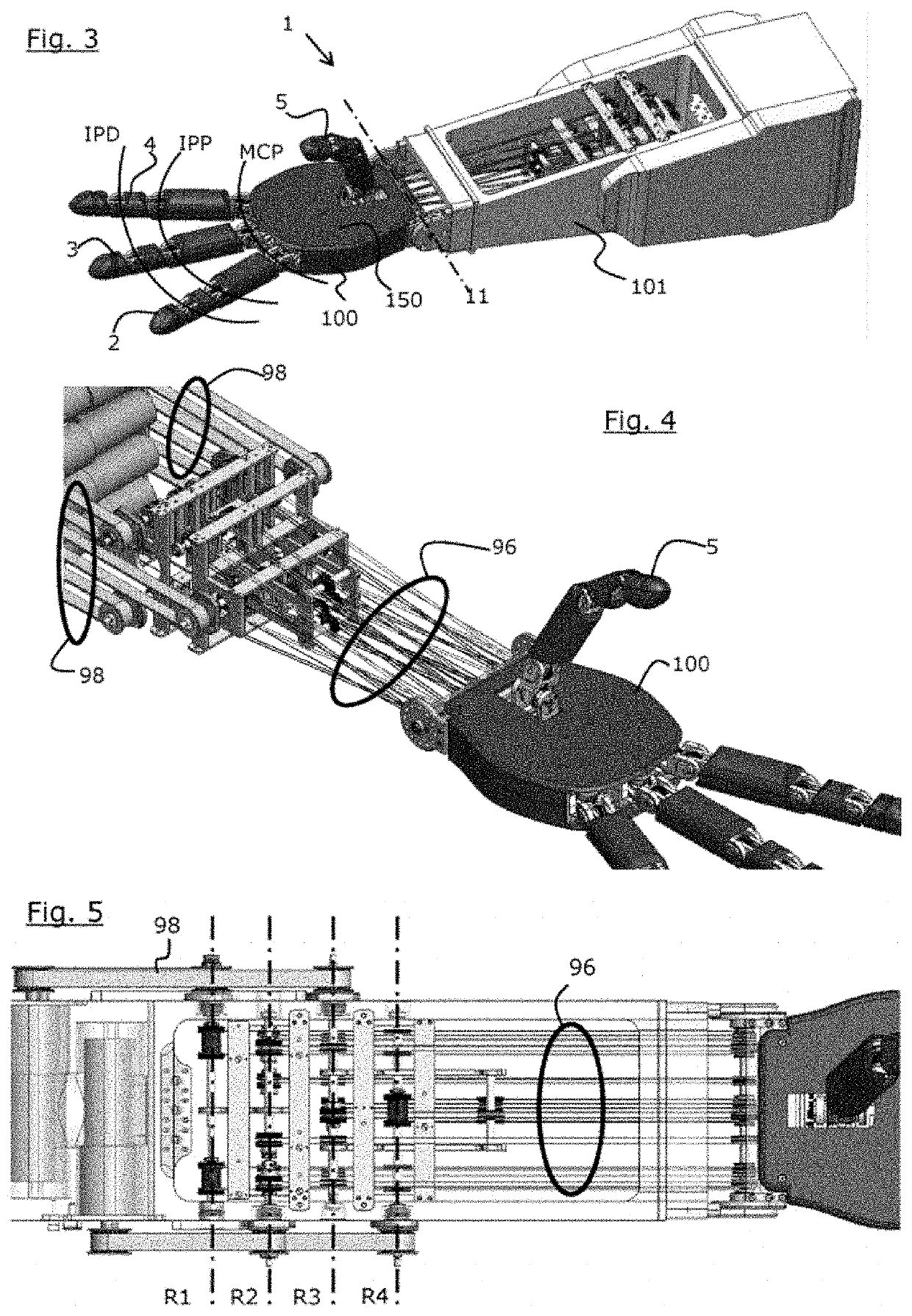 Robotic hand