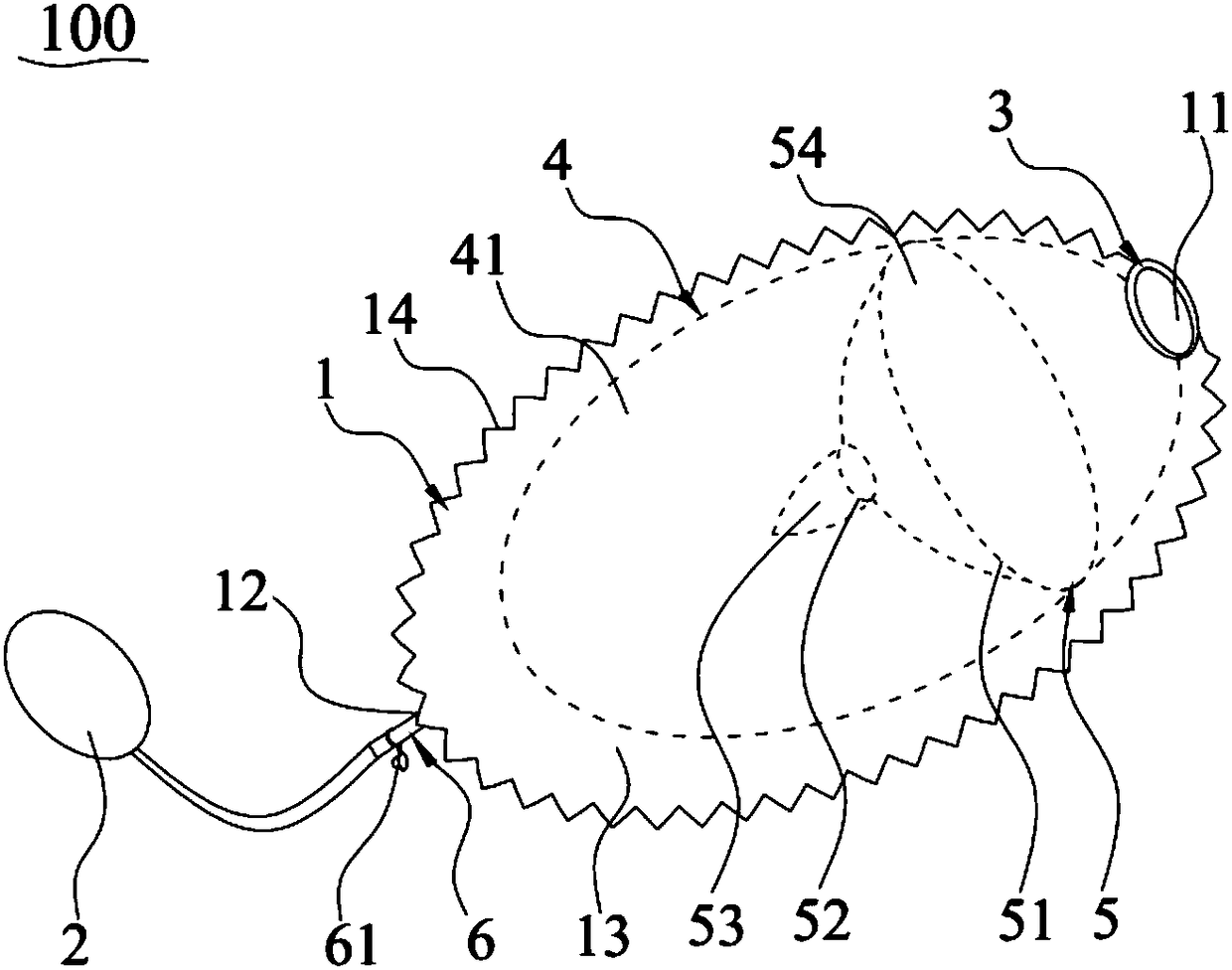 Negative-pressure colostomy bag