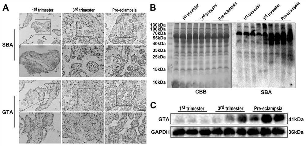 Biomarker for predicting preeclampsia and application thereof