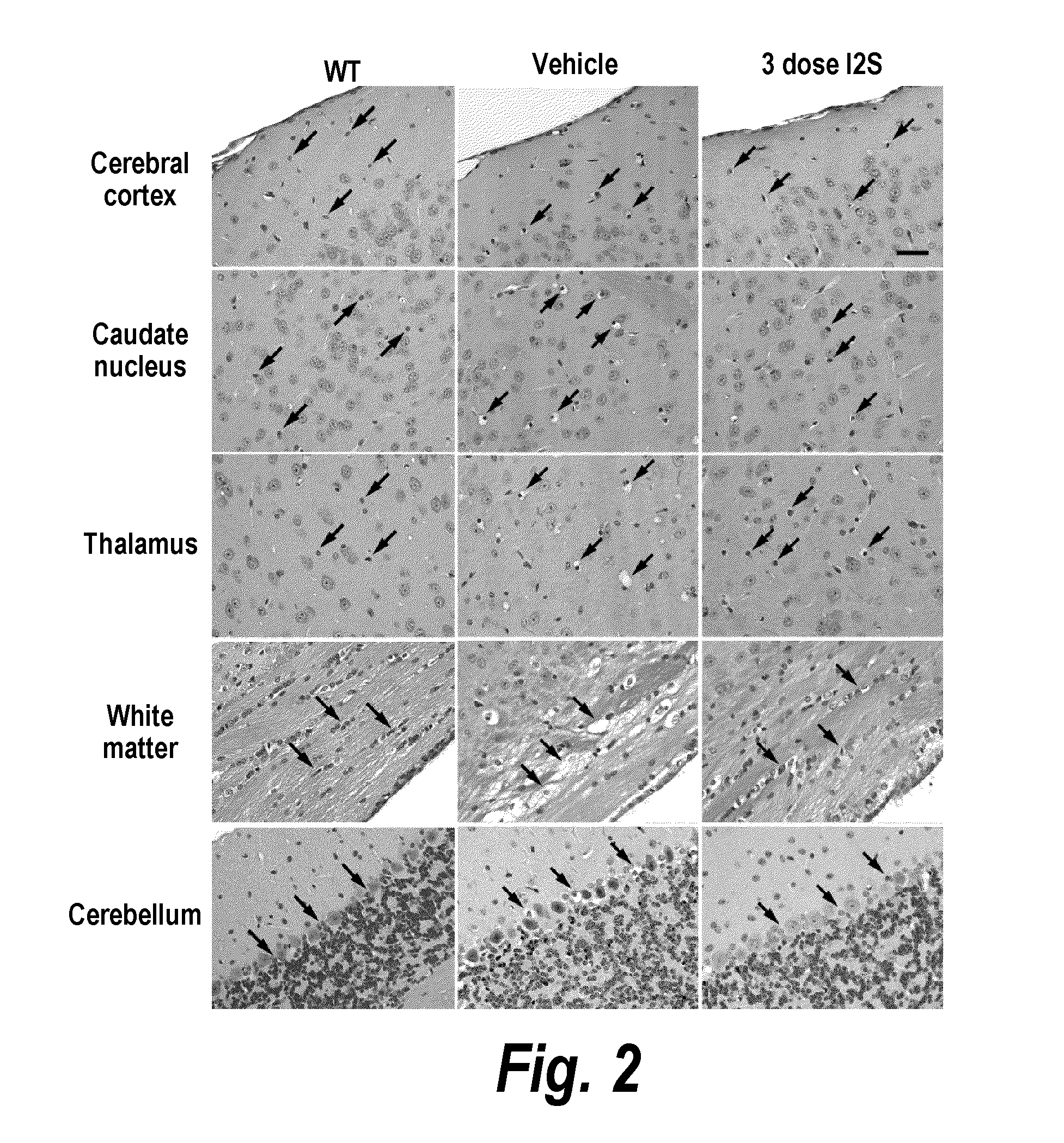 Methods and compositions for CNS delivery of iduronate-2-sulfatase