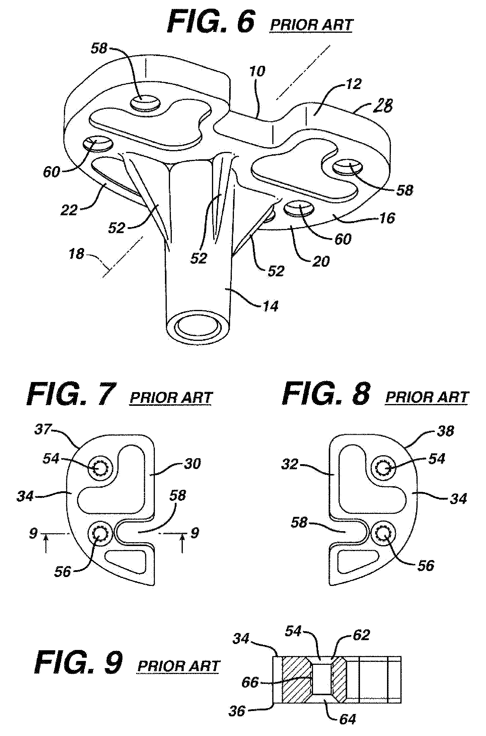 Universal tibial augment