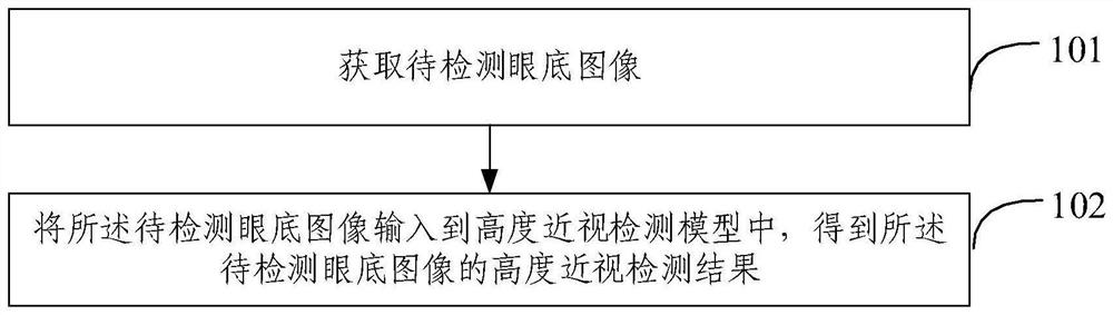 High myopia detection method based on eye fundus image and related device