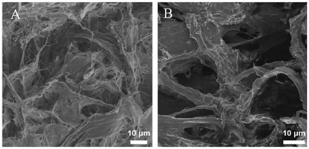 Neural/vascular network based on animal adipose tissue-derived hydrogel and construction method and application thereof