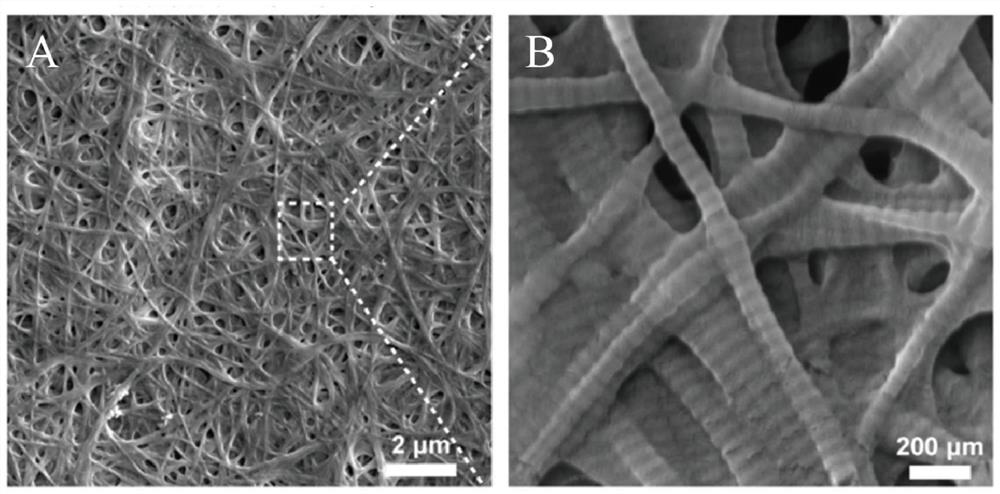 Neural/vascular network based on animal adipose tissue-derived hydrogel and construction method and application thereof