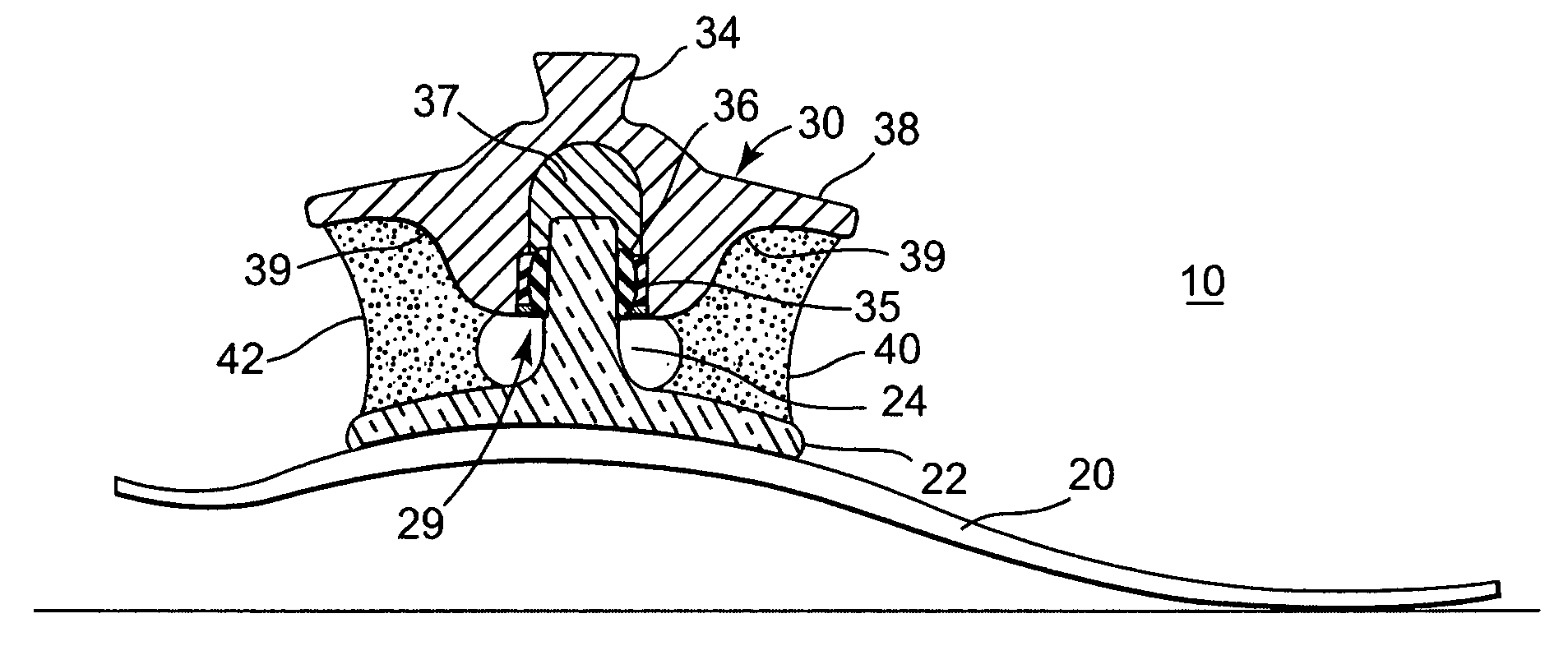 Multi-axial prosthetic foot