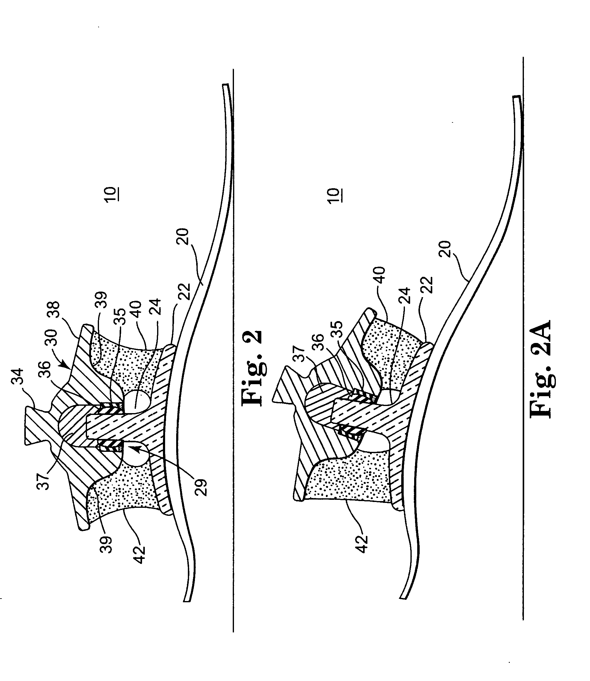 Multi-axial prosthetic foot