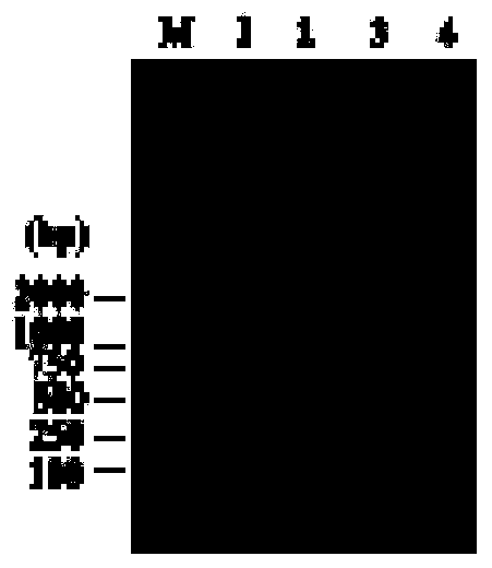 Primer pair for detecting AKV and application thereof