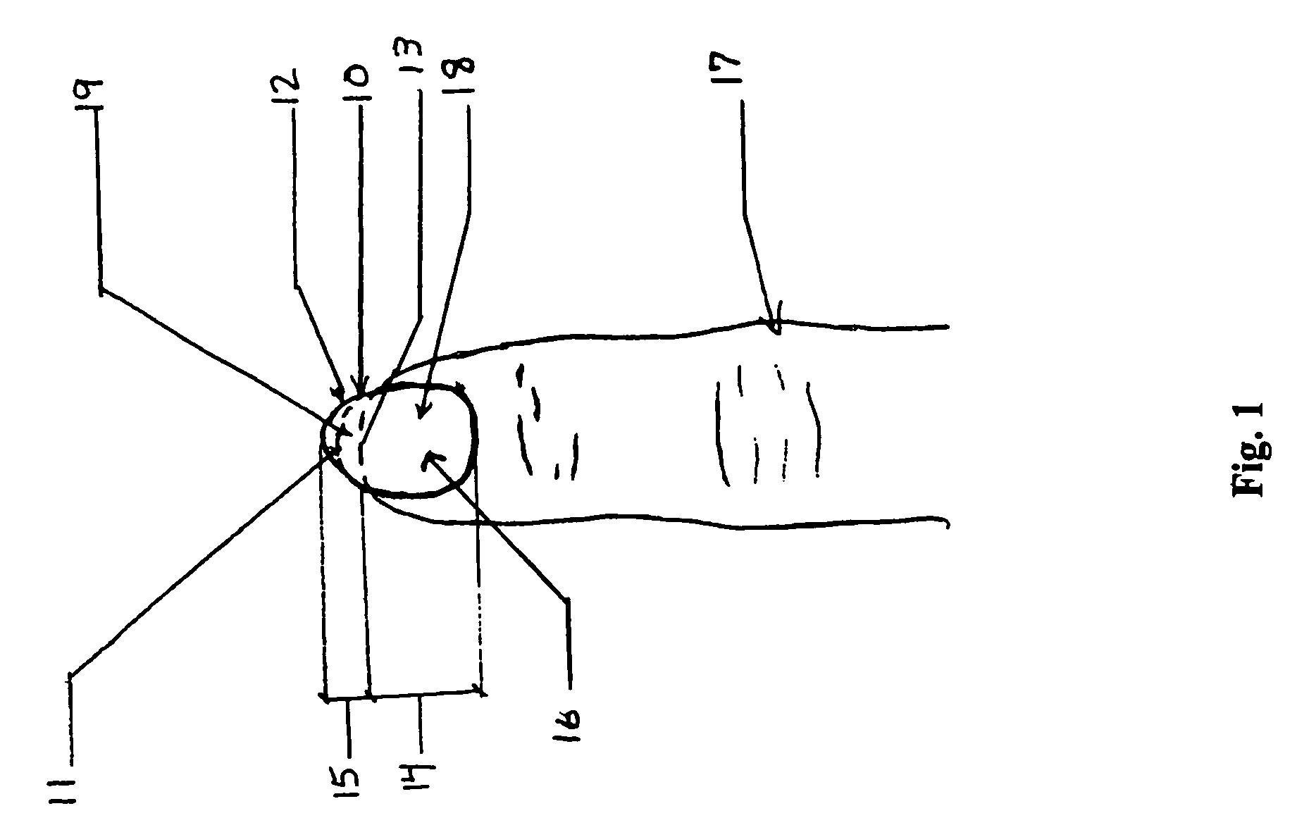 Fingernail pick for stringed instruments