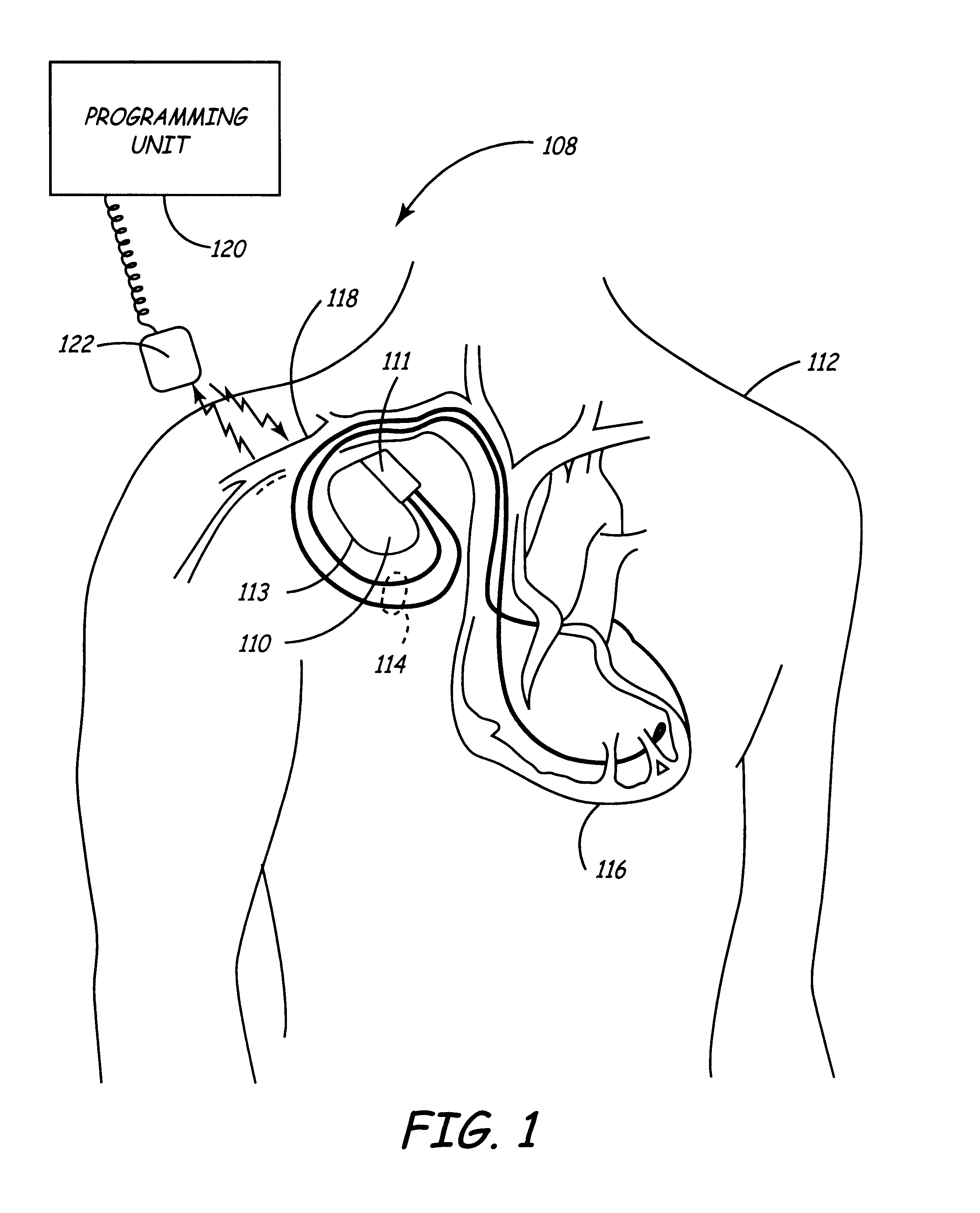 Downloadable software support in a pacemaker