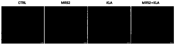 Antineoplastic hydrogel polypeptide and preparation method