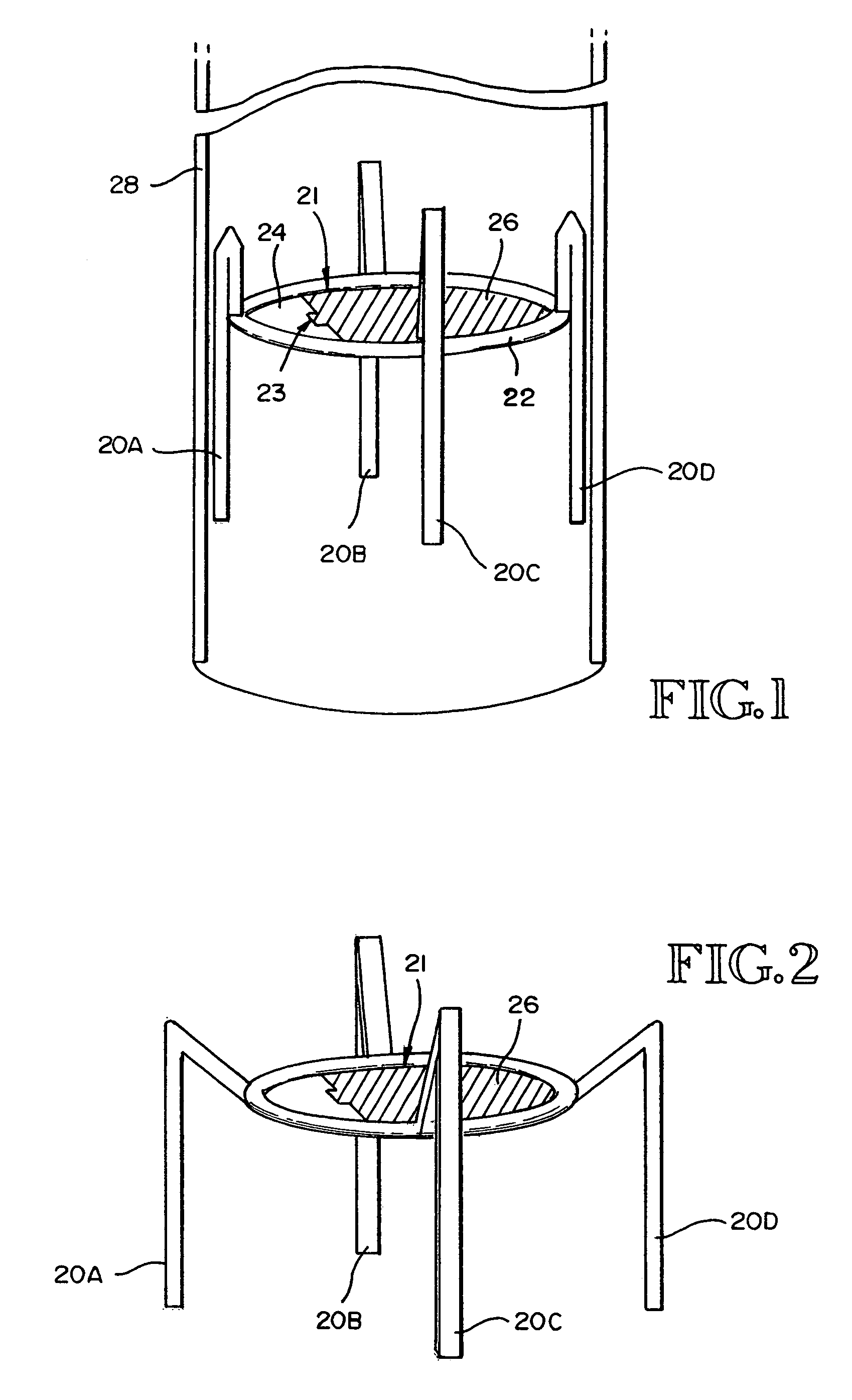 Methods and devices for improving breathing in patients with pulmonary disease