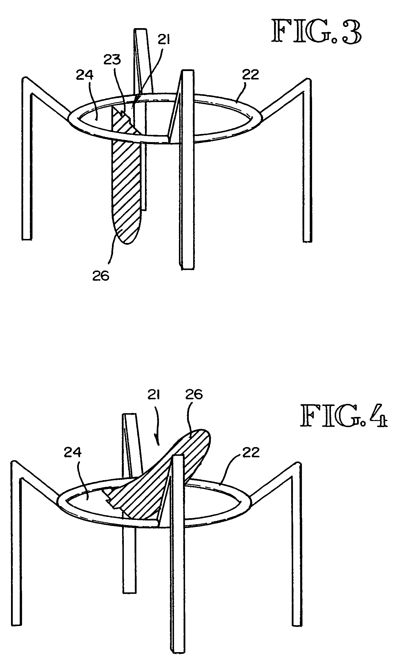 Methods and devices for improving breathing in patients with pulmonary disease