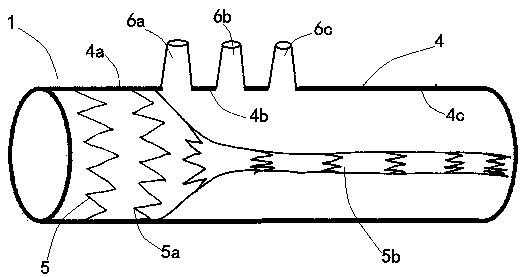 Covered stent type blood vessel combined kit for isolating aortic arch part and three branches