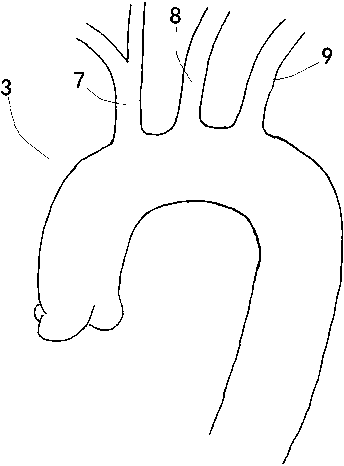 Covered stent type blood vessel combined kit for isolating aortic arch part and three branches