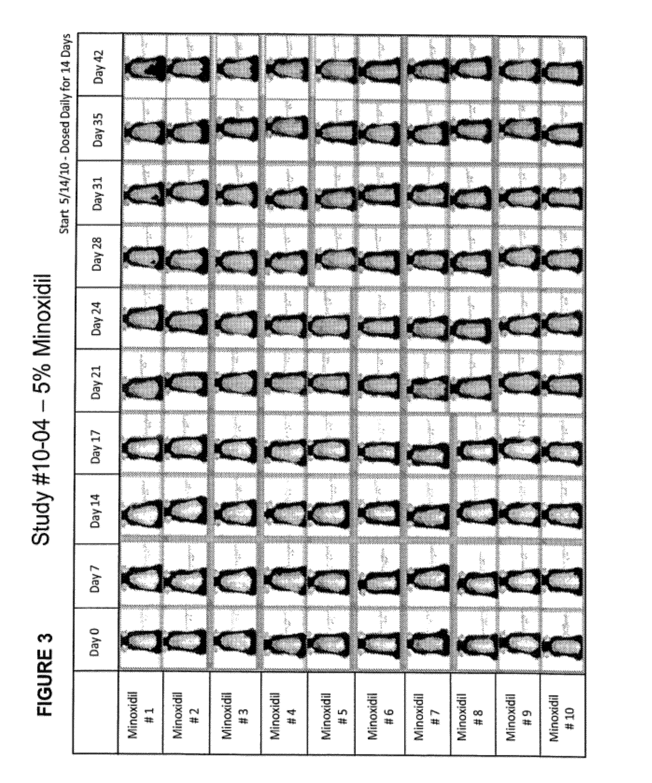 Method of enhancing hair growth