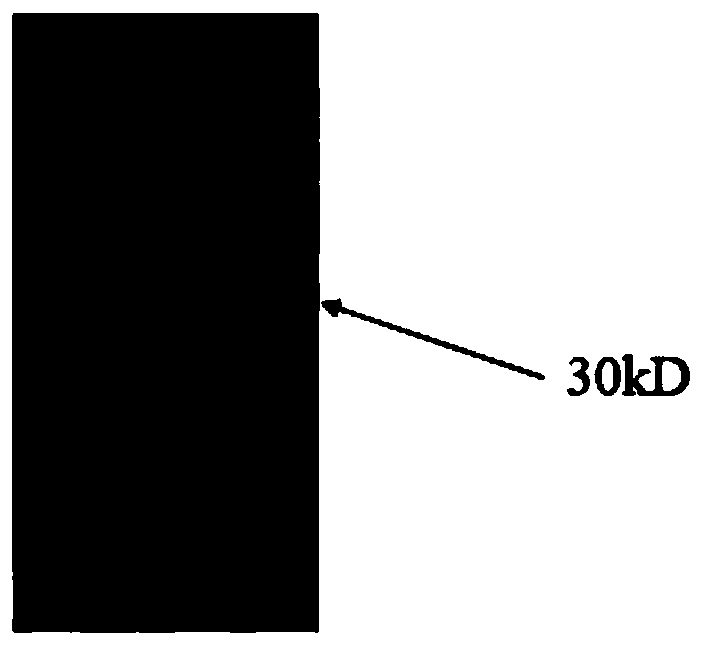 Active immune regulation particle, and preparation method and application thereof