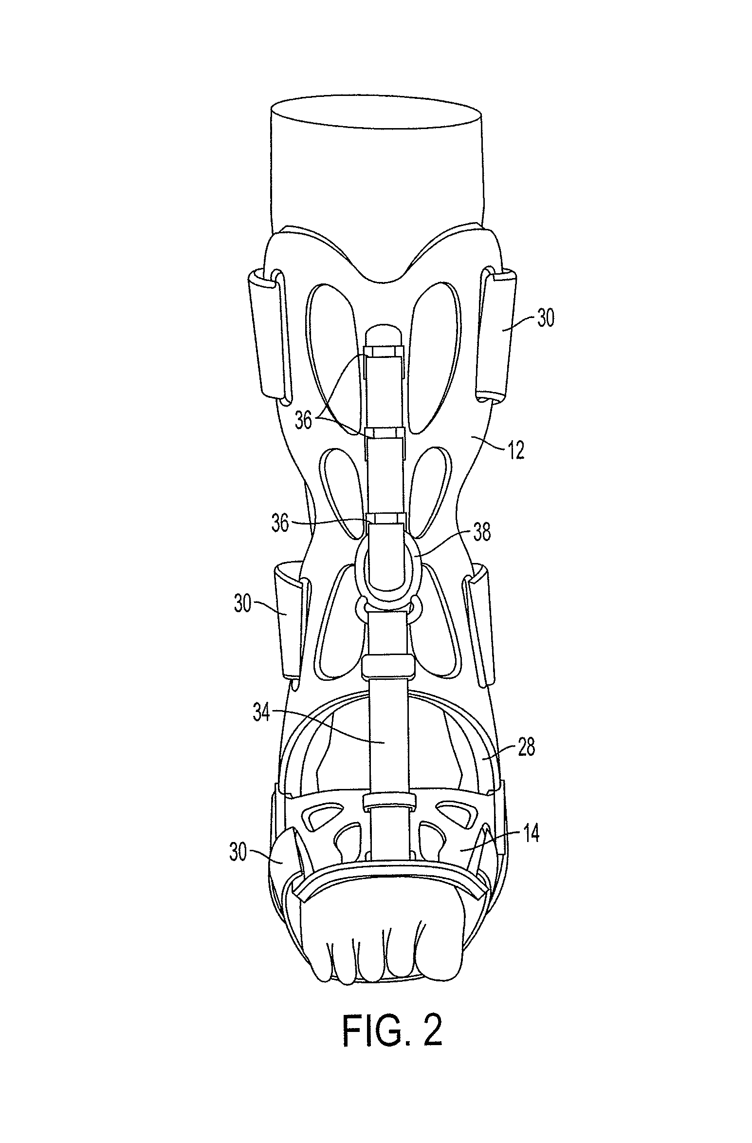 Adjustable splinting device