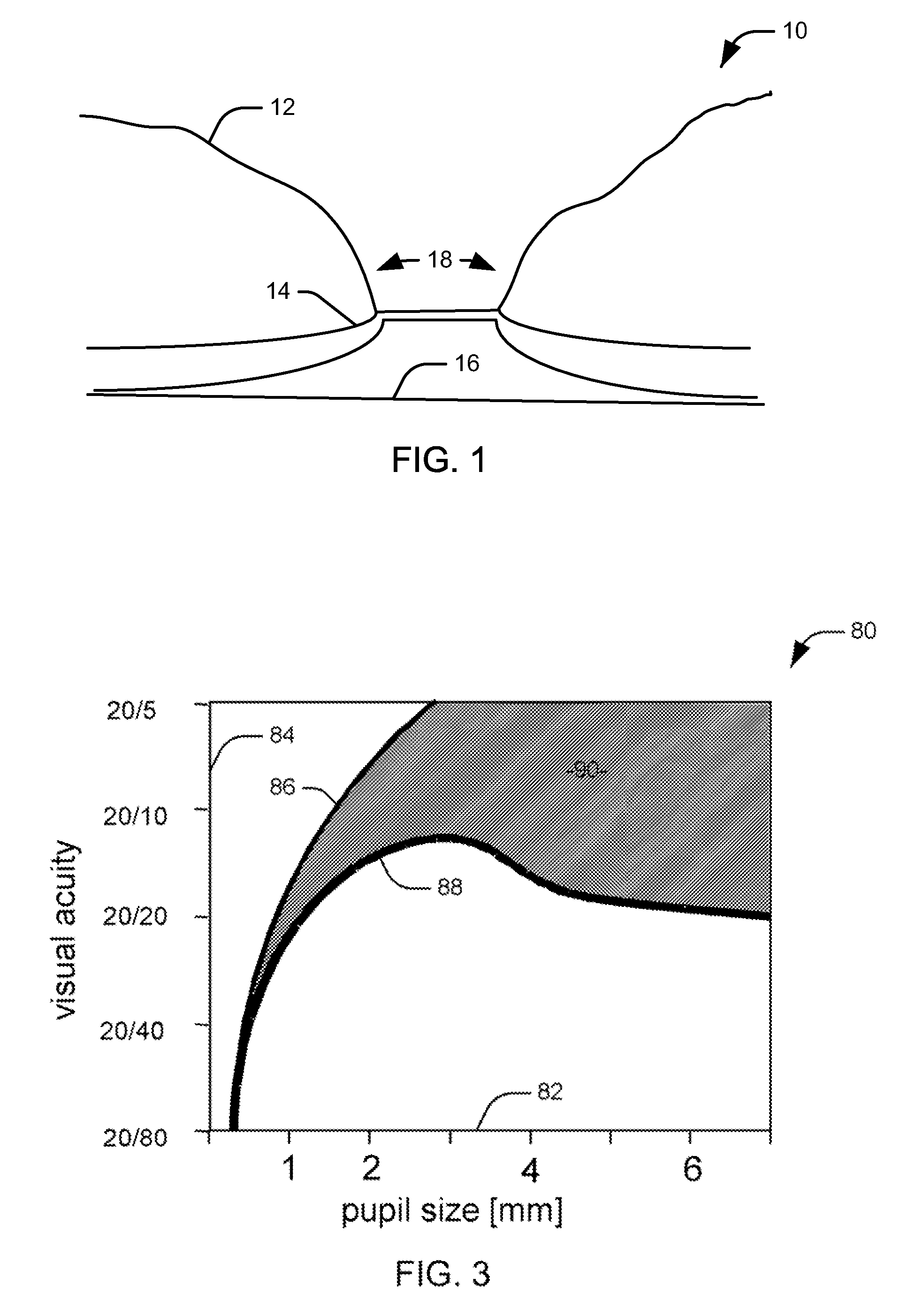 Precise disruption of tissue in retinal and preretinal structures