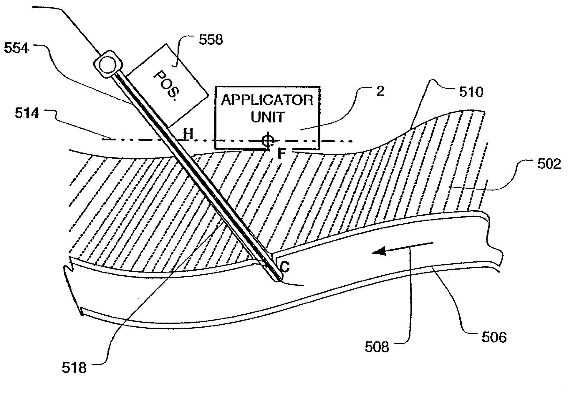 Use of focused ultrasound for vascular sealing