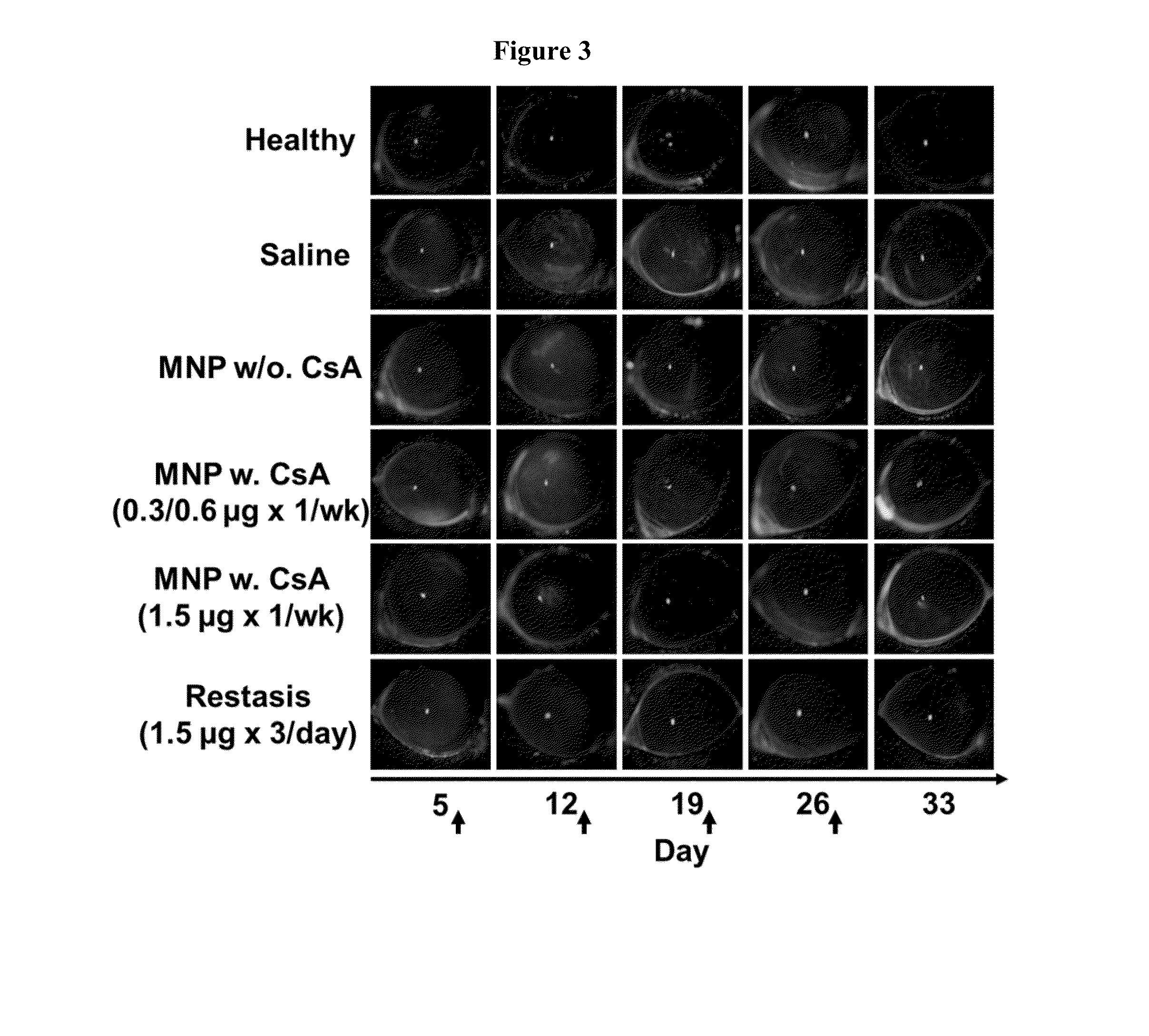 Mucoadhesive nanoparticle composition comprising immunosuppresant and methods of use thereof