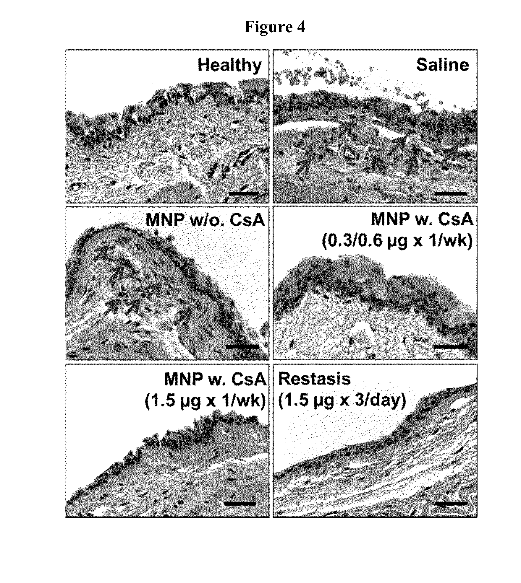 Mucoadhesive nanoparticle composition comprising immunosuppresant and methods of use thereof