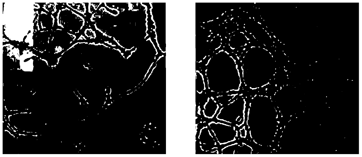 Preparation method of traditional Chinese medicine monomer sequence slow-release osteogenic angiogenesis calcium phosphorus scaffold material