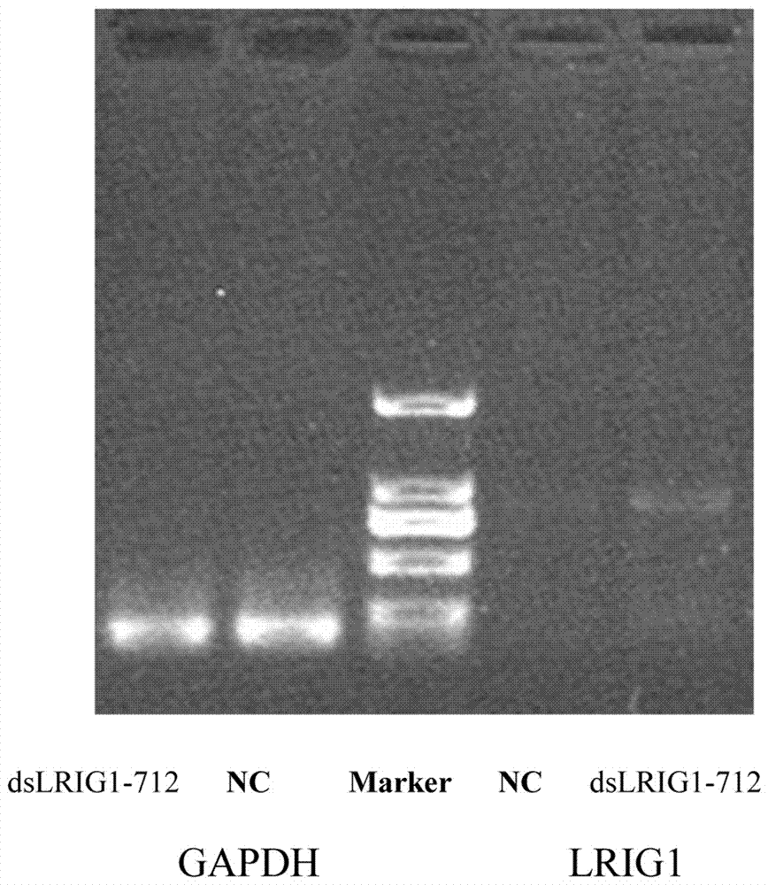 Micromolecule for activating LRIG1 expression in brain glioma U251 cells and screening method and application of micromolecule