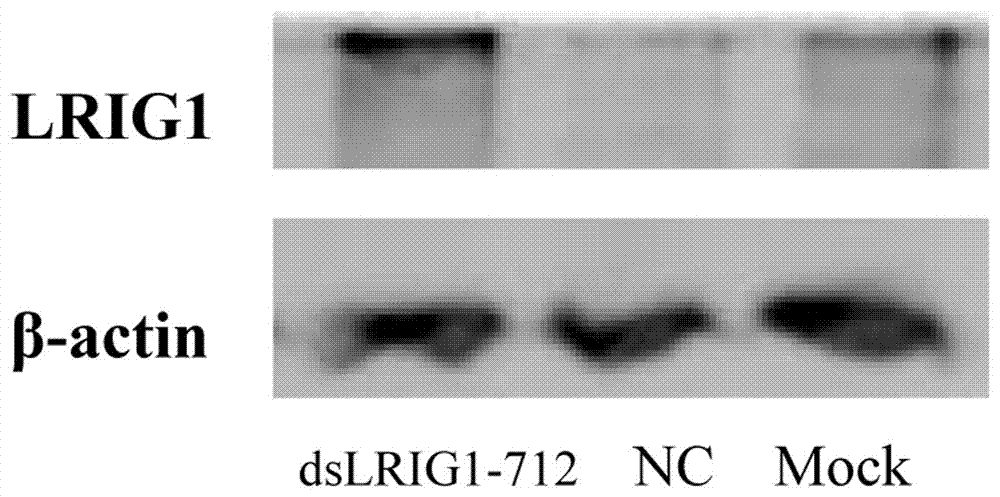 Micromolecule for activating LRIG1 expression in brain glioma U251 cells and screening method and application of micromolecule