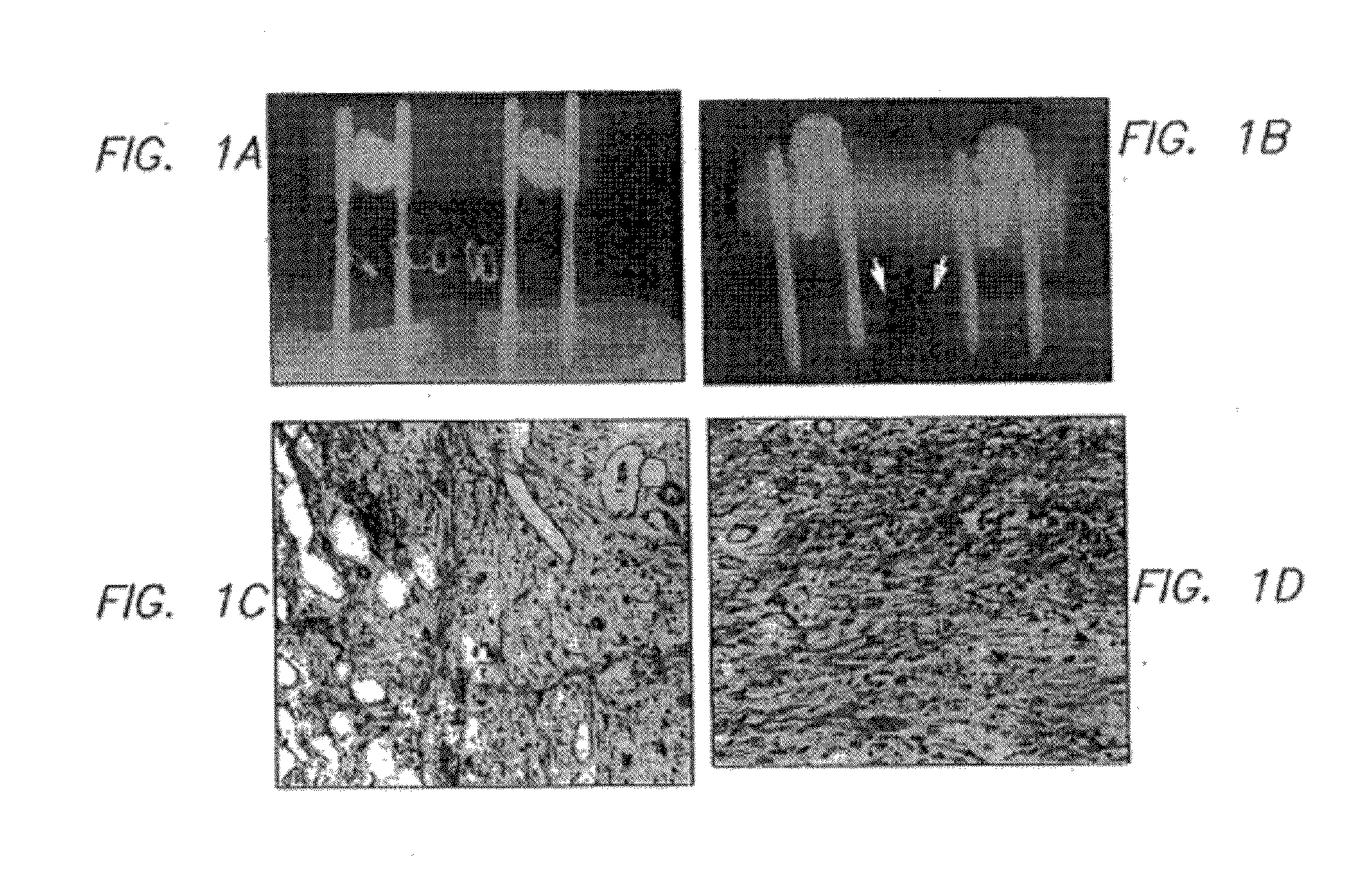 In vivo transfer methods for wound healing